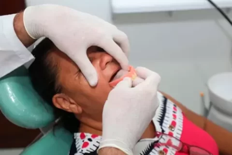 Implante dentário pelo SUS – Como conseguir grátis!